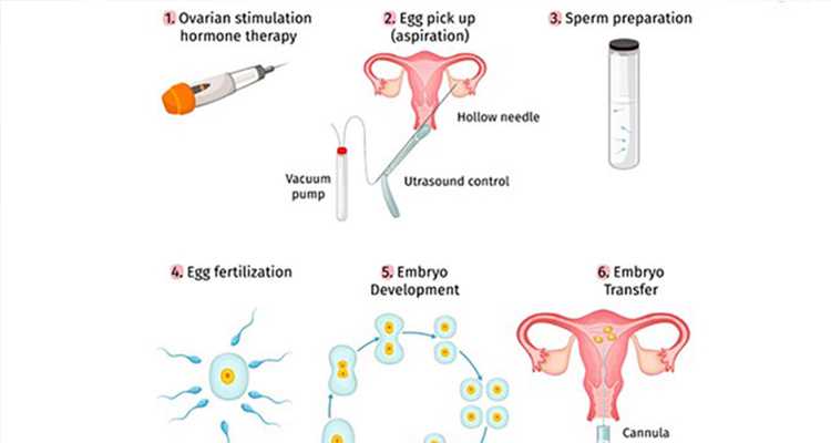 2万找私人代妈_47岁试管供卵_T08n7_孕初期白带偏黄伴有炎症，可以使用甲硝唑凝