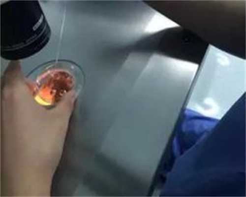 最著名南昌代孕试管医院_09534_瑞白上午打还是下午打好？_0uE99_9s78k_Qi2CI_99113